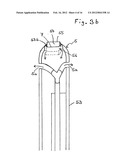 One-Hand Device for Ophthalmic Surgery diagram and image