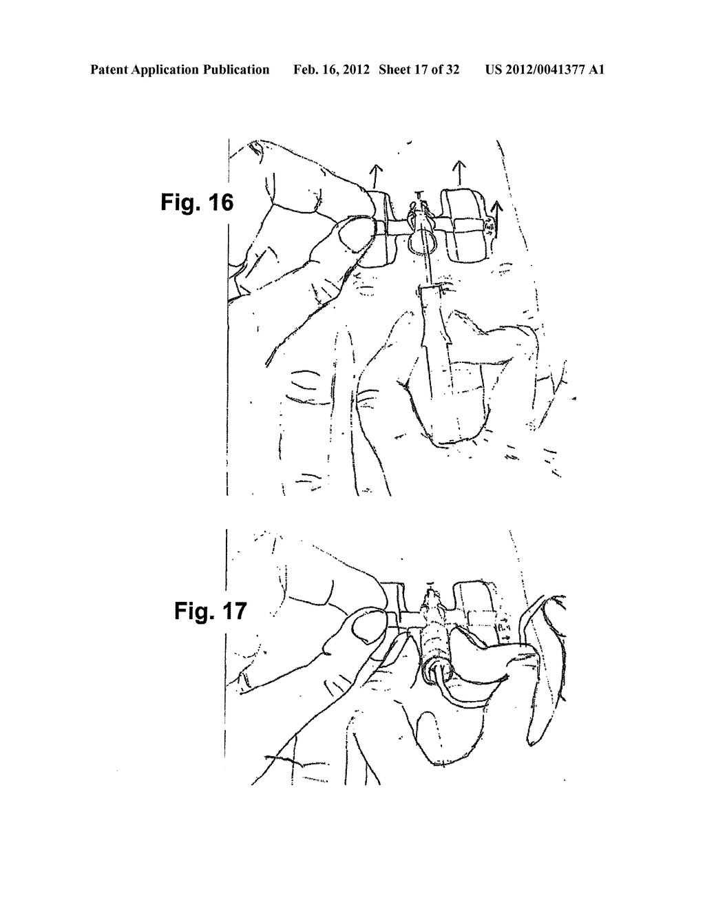 Catheter Anchoring System, Apparatus and Method - diagram, schematic, and image 18