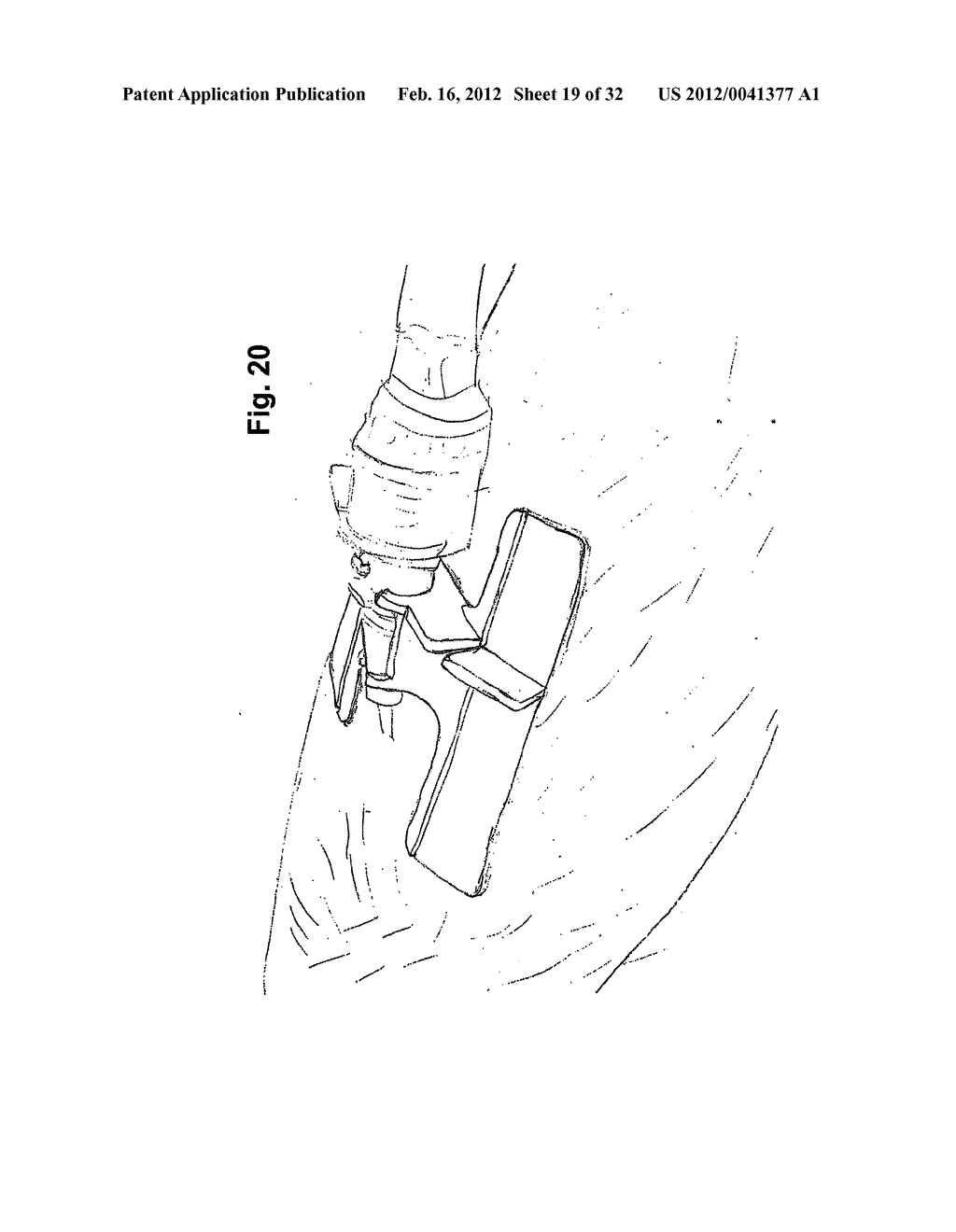 Catheter Anchoring System, Apparatus and Method - diagram, schematic, and image 20