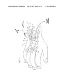 CATHETER ANCHORING SYSTEM diagram and image