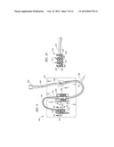 CATHETER ANCHORING SYSTEM diagram and image