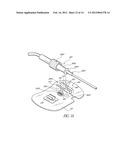 CATHETER ANCHORING SYSTEM diagram and image