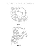 BIOLOGIC TREATMENT SYSTEM AND METHOD diagram and image