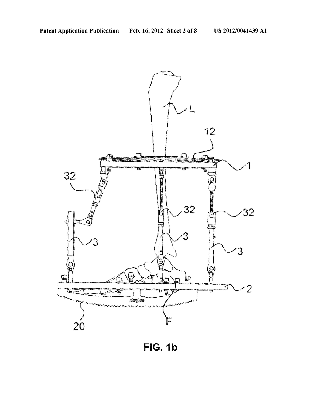 EXTERNAL FIXATOR SYSTEM - diagram, schematic, and image 03