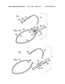 CABLE TIE SYSTEM FOR STABILIZING BONE diagram and image