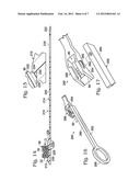 CABLE TIE SYSTEM FOR STABILIZING BONE diagram and image