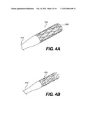 DEVICE AND METHOD FOR CLOT ENGAGEMENT AND CAPTURE diagram and image