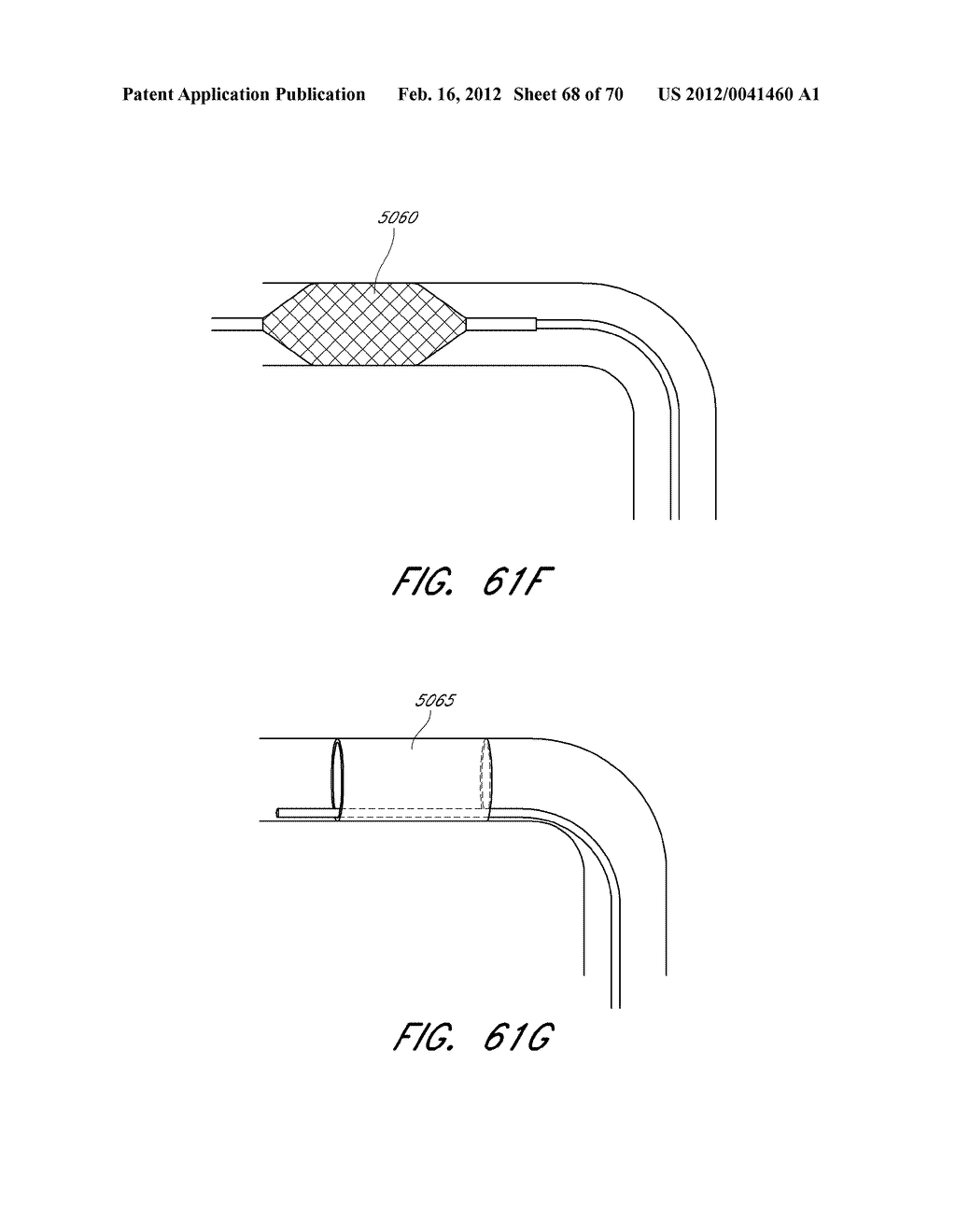 THROMBUS MANAGEMENT SYSTEM - diagram, schematic, and image 69