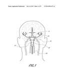 THROMBUS MANAGEMENT DEVICE diagram and image