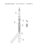 THROMBUS MANAGEMENT DEVICE diagram and image