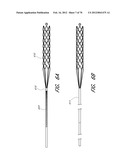 THROMBUS MANAGEMENT DEVICE diagram and image