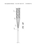 THROMBUS MANAGEMENT DEVICE diagram and image