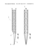 THROMBUS MANAGEMENT DEVICE diagram and image