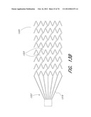 THROMBUS MANAGEMENT DEVICE diagram and image