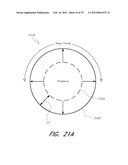 THROMBUS MANAGEMENT DEVICE diagram and image