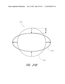 THROMBUS MANAGEMENT DEVICE diagram and image