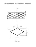 THROMBUS MANAGEMENT DEVICE diagram and image