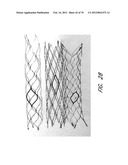 THROMBUS MANAGEMENT DEVICE diagram and image