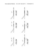 THROMBUS MANAGEMENT DEVICE diagram and image