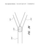 THROMBUS MANAGEMENT DEVICE diagram and image