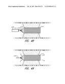 THROMBUS MANAGEMENT DEVICE diagram and image