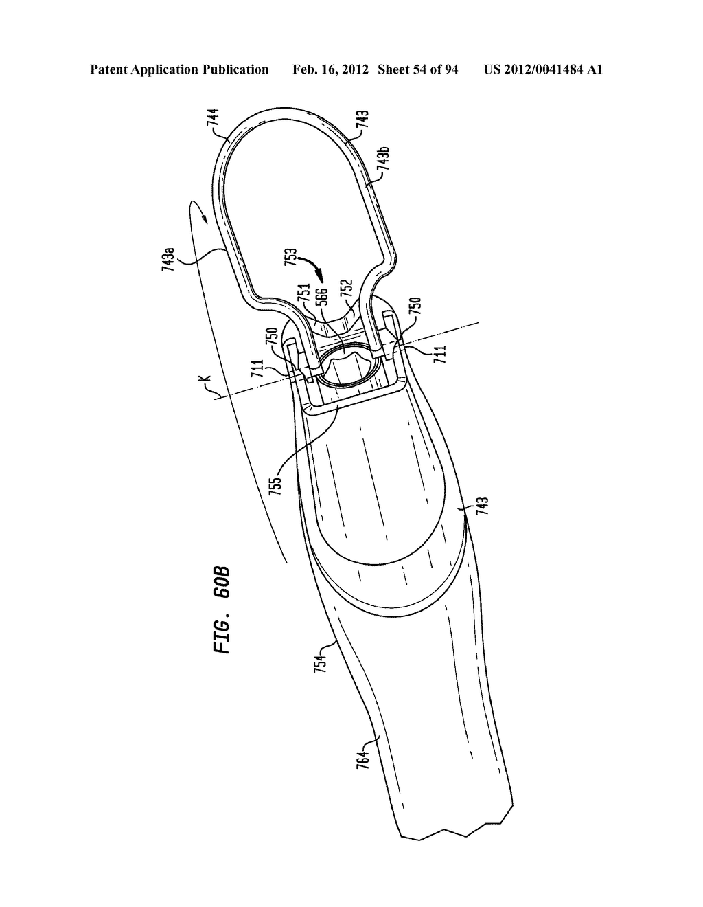 MEDICAL DEVICE AND PROCEDURE FOR ATTACHING TISSUE TO BONE - diagram, schematic, and image 55