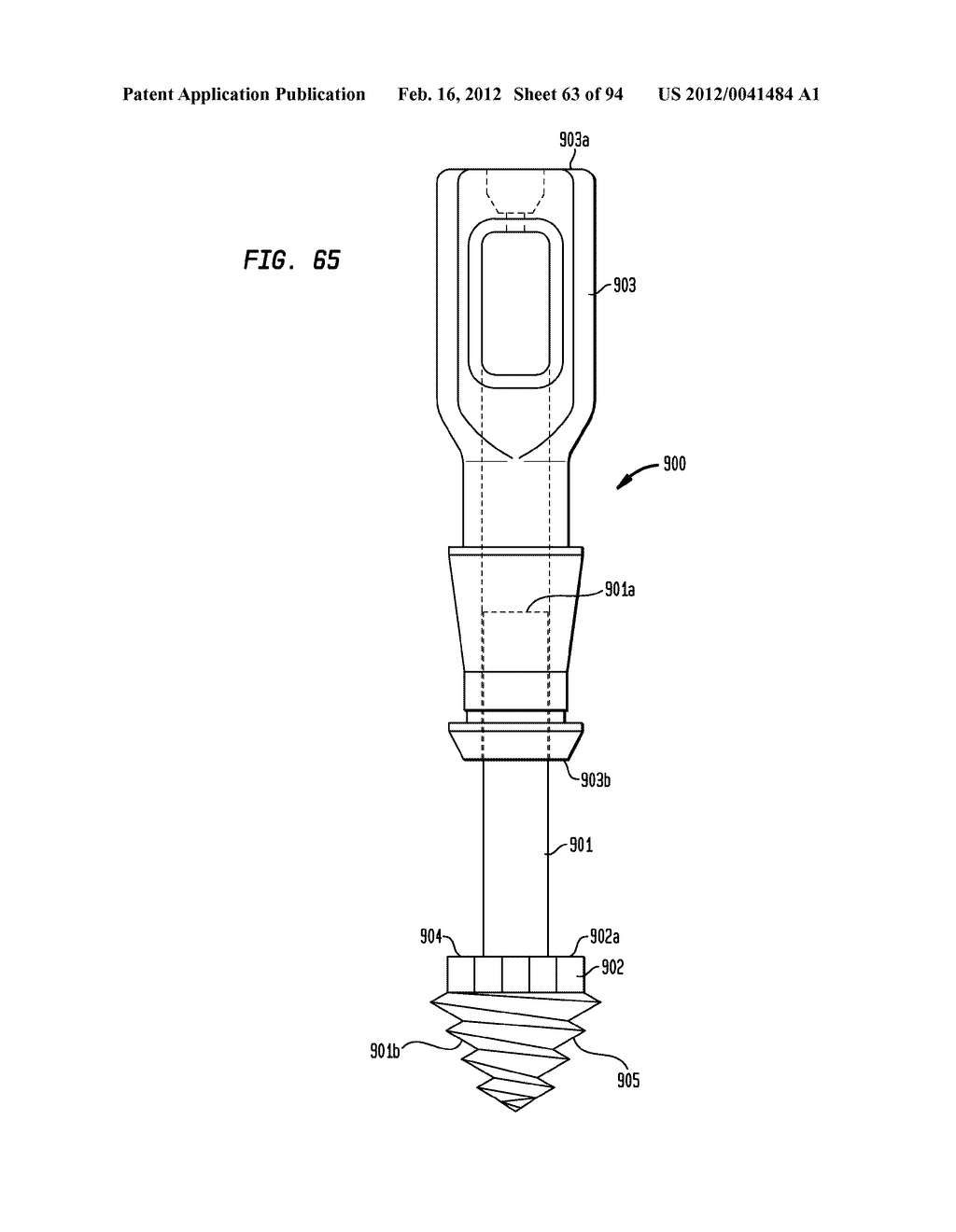 MEDICAL DEVICE AND PROCEDURE FOR ATTACHING TISSUE TO BONE - diagram, schematic, and image 64