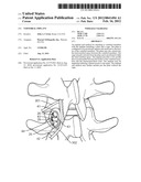 VERTEBRAL IMPLANT diagram and image