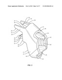 VERTEBRAL IMPLANT diagram and image