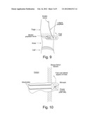 Device diagram and image