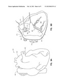 SAFETY CONTROL SYSTEM FOR IMPLANTABLE NEURAL STIMULATOR diagram and image