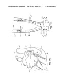 SAFETY CONTROL SYSTEM FOR IMPLANTABLE NEURAL STIMULATOR diagram and image