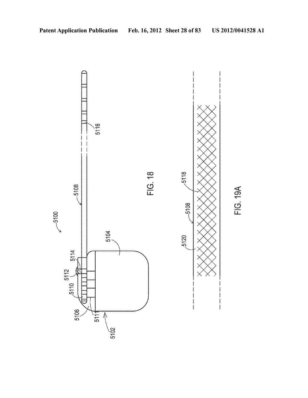 TERMINATION OF A SHIELD WITHIN AN IMPLANTABLE MEDICAL LEAD - diagram, schematic, and image 29