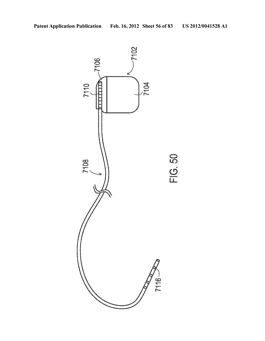 TERMINATION OF A SHIELD WITHIN AN IMPLANTABLE MEDICAL LEAD - diagram, schematic, and image 57