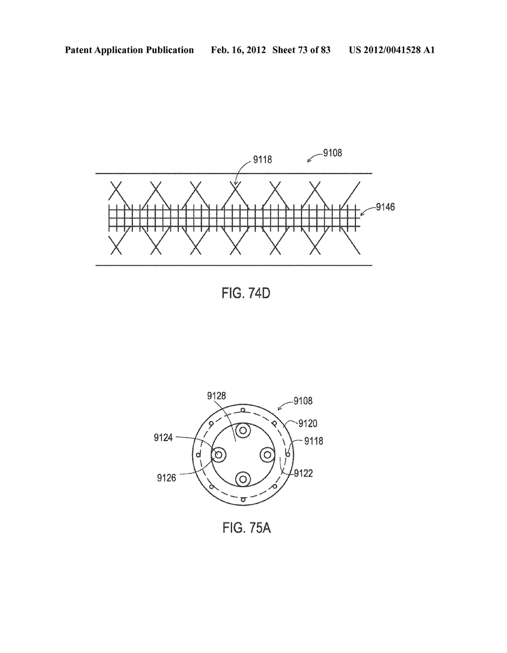 TERMINATION OF A SHIELD WITHIN AN IMPLANTABLE MEDICAL LEAD - diagram, schematic, and image 74