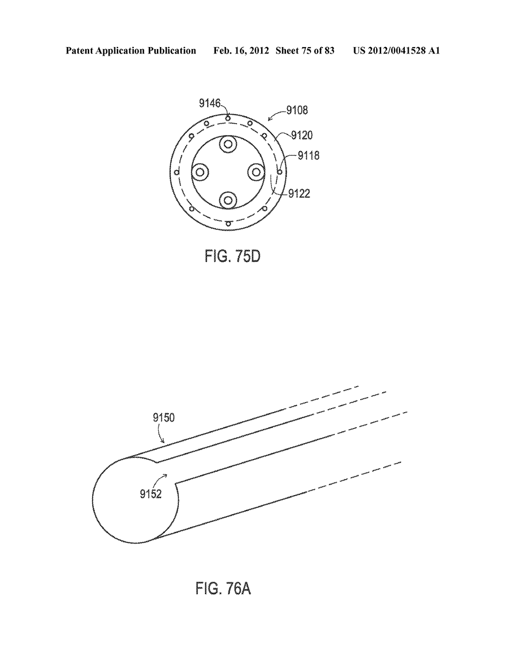 TERMINATION OF A SHIELD WITHIN AN IMPLANTABLE MEDICAL LEAD - diagram, schematic, and image 76