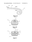 COCHLEAR IMPLANT WITH IMPROVED LUMEN ARRANGEMENT diagram and image