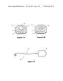 COCHLEAR IMPLANT WITH IMPROVED LUMEN ARRANGEMENT diagram and image