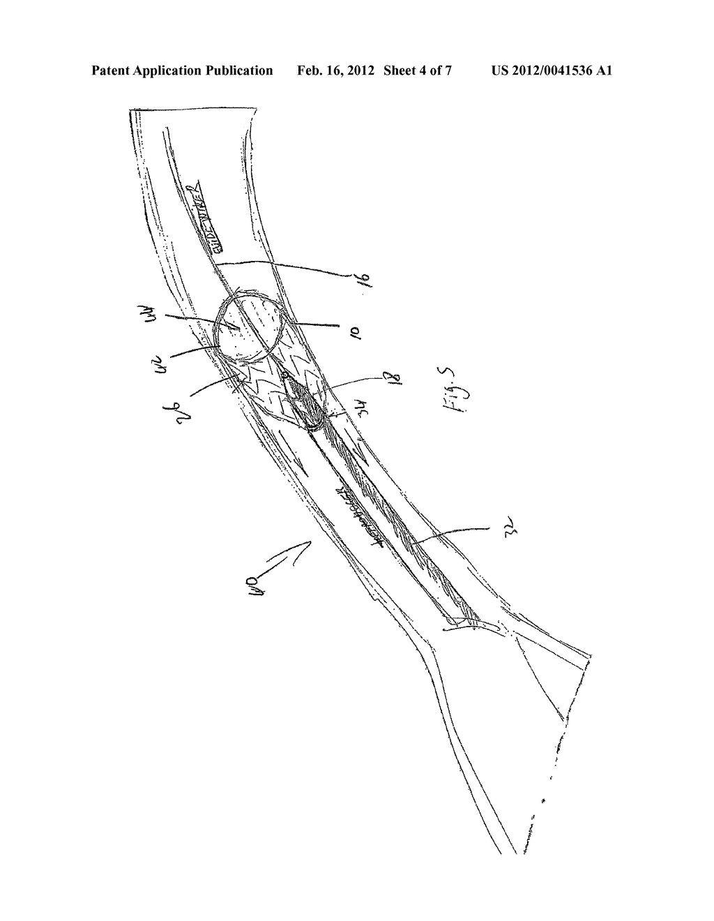 INTRODUCER ASSEMBLY - diagram, schematic, and image 05