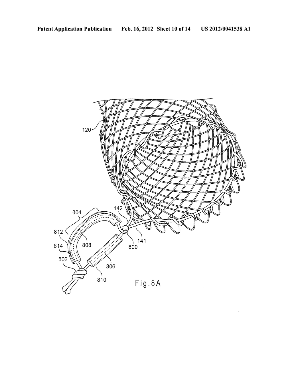 COLLAPSING STRUCTURE FOR REDUCING THE DIAMETER OF A STENT END - diagram, schematic, and image 11