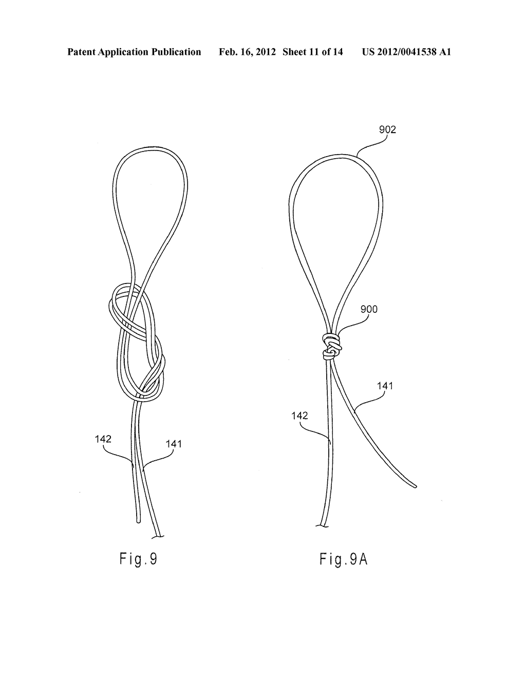 COLLAPSING STRUCTURE FOR REDUCING THE DIAMETER OF A STENT END - diagram, schematic, and image 12