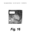 PROTEIN BIOMATERIAL AND BIOCOACERVATE VESSEL GRAFT SYSTEMS AND METHODS OF     MAKING AND USING THEREOF diagram and image