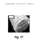 PROTEIN BIOMATERIAL AND BIOCOACERVATE VESSEL GRAFT SYSTEMS AND METHODS OF     MAKING AND USING THEREOF diagram and image