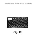 PROTEIN BIOMATERIAL AND BIOCOACERVATE VESSEL GRAFT SYSTEMS AND METHODS OF     MAKING AND USING THEREOF diagram and image