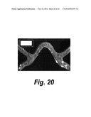 PROTEIN BIOMATERIAL AND BIOCOACERVATE VESSEL GRAFT SYSTEMS AND METHODS OF     MAKING AND USING THEREOF diagram and image