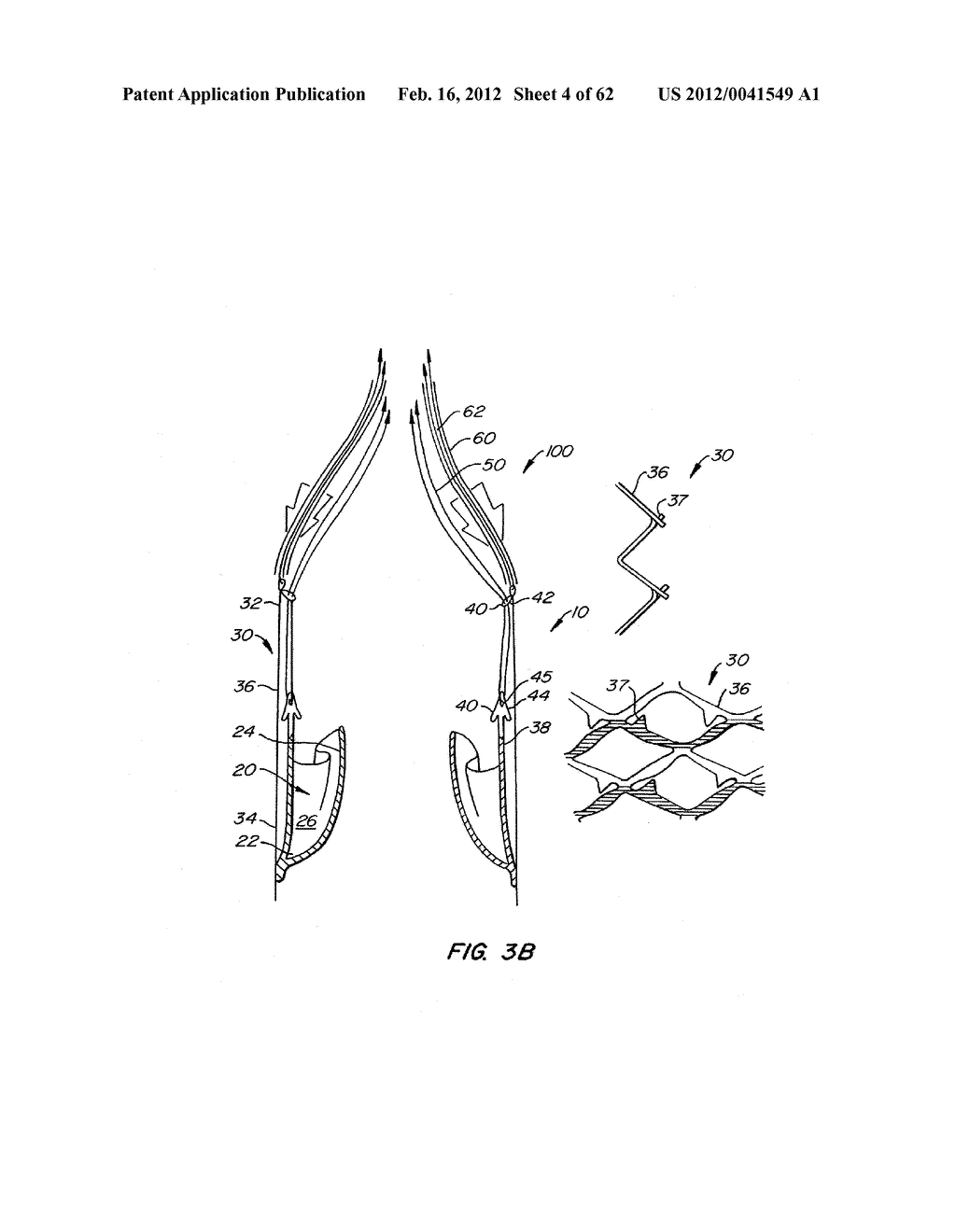 REPOSITIONABLE HEART VALVE AND METHOD - diagram, schematic, and image 05