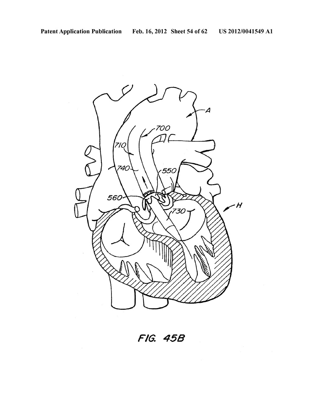 REPOSITIONABLE HEART VALVE AND METHOD - diagram, schematic, and image 55