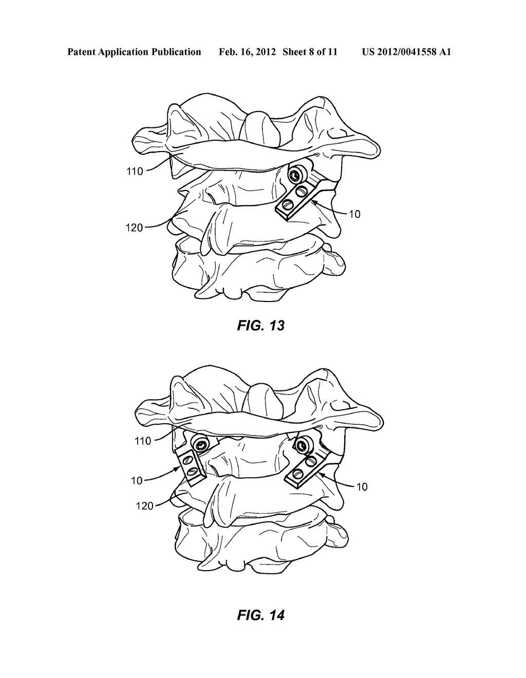 C1 - C2 IMPLANT AND METHODS OF USE - diagram, schematic, and image 09