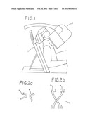 Resurfacing implant for a humeral head diagram and image