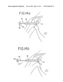 Resurfacing implant for a humeral head diagram and image